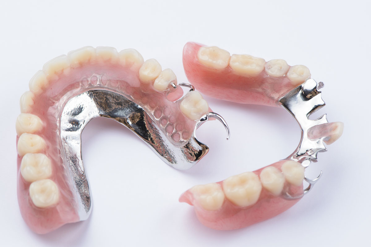 Dents artificielles et prothèse amovible - ScienceDirect